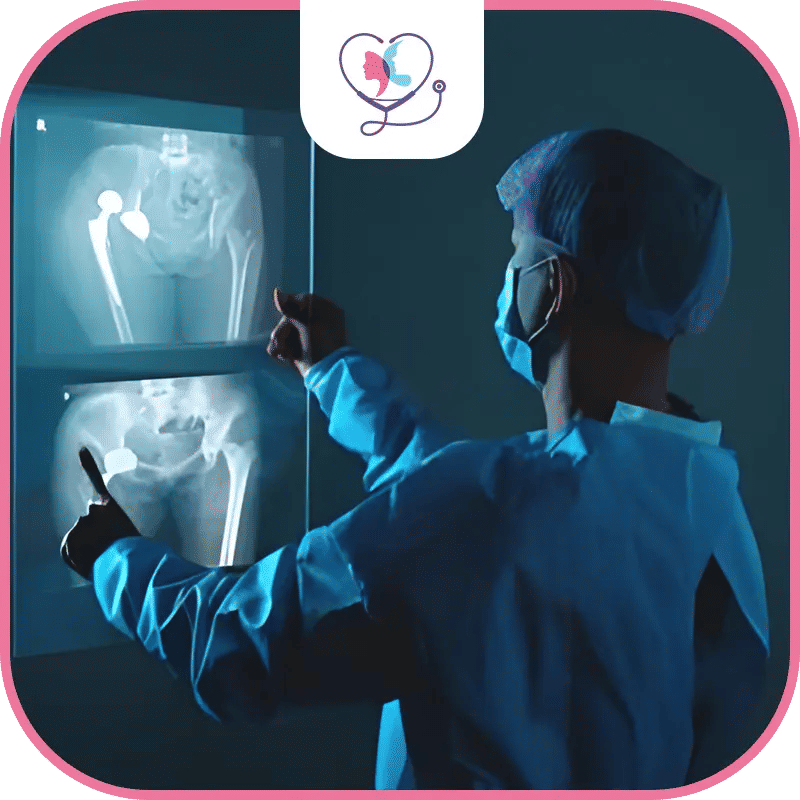 العوامل المؤثرة على نجاح استبدال مفصل الورك