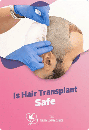 Ist Haartransplantation sicher