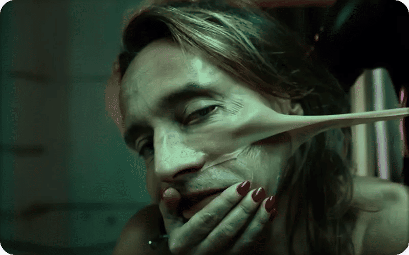 Pourquoi tout le monde parle de la chirurgie de Bob Sinclar ?