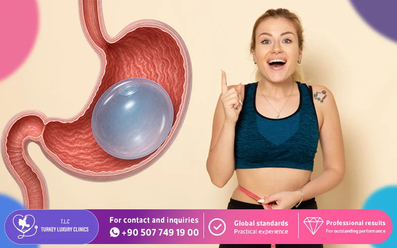 What is a Gastric Balloon Weight Loss Procedure?