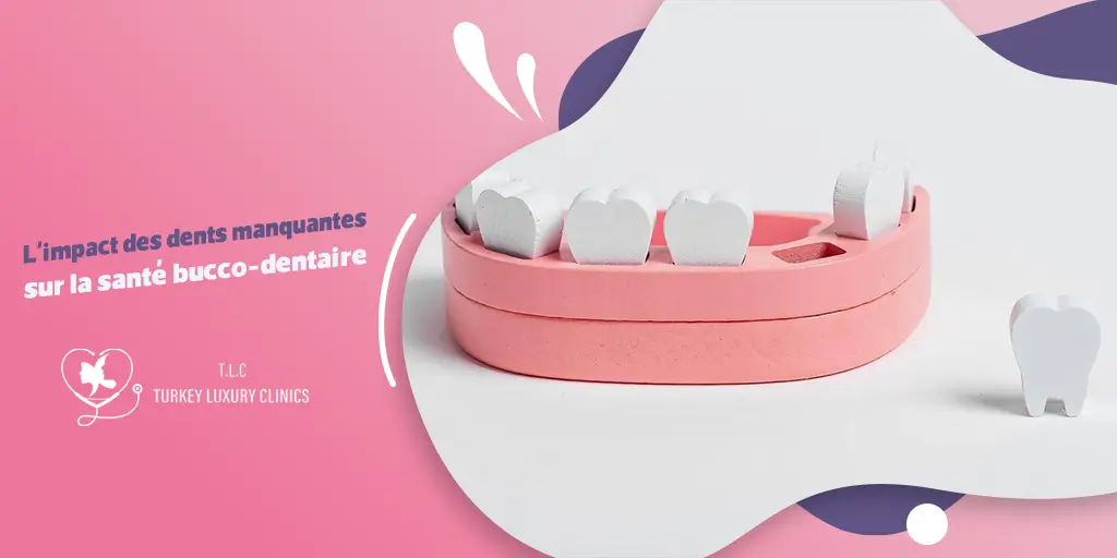 L'impact des dents manquantes sur la santé bucco-dentaire