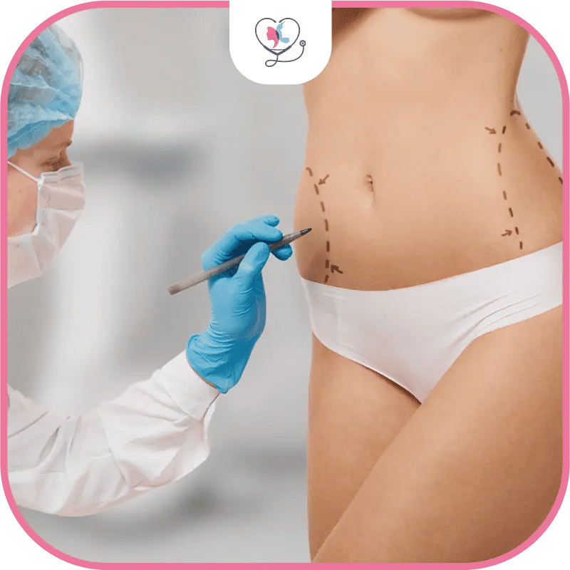 ما هي مزايا وعيوب شفط الدهون؟