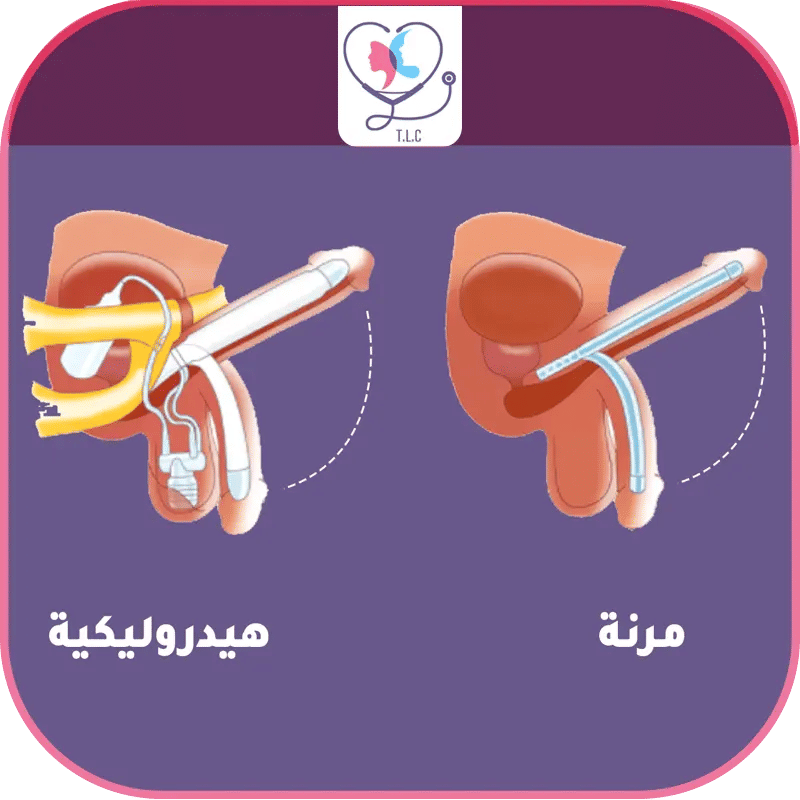 دعامة القضيب