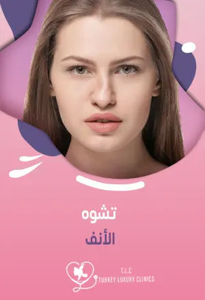 تشوه الأنف: أسبابه وخيارات التجميل المتاحةfeatured image
