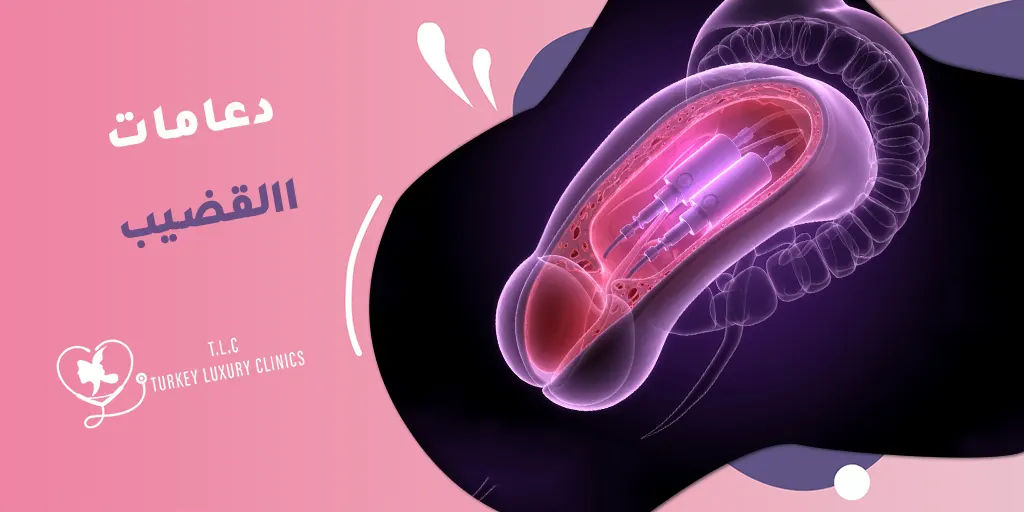 دعامة القضيب: ما هي، ومتى يُنصح بها طبيًا؟