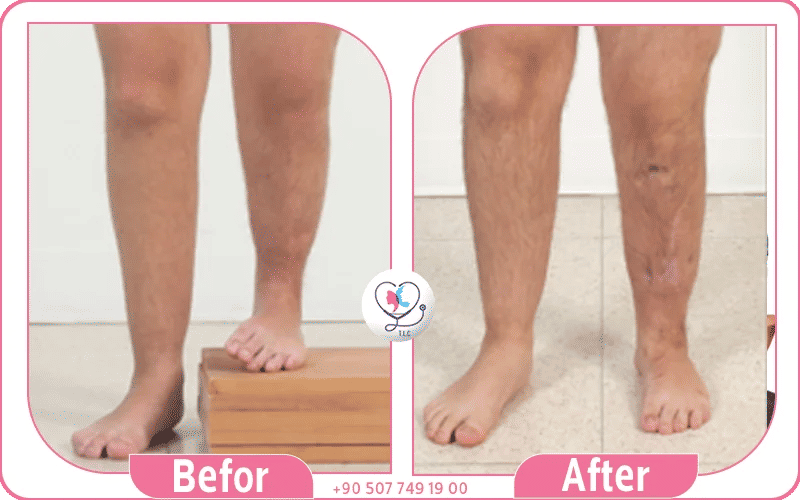 العلاجات الجراحية