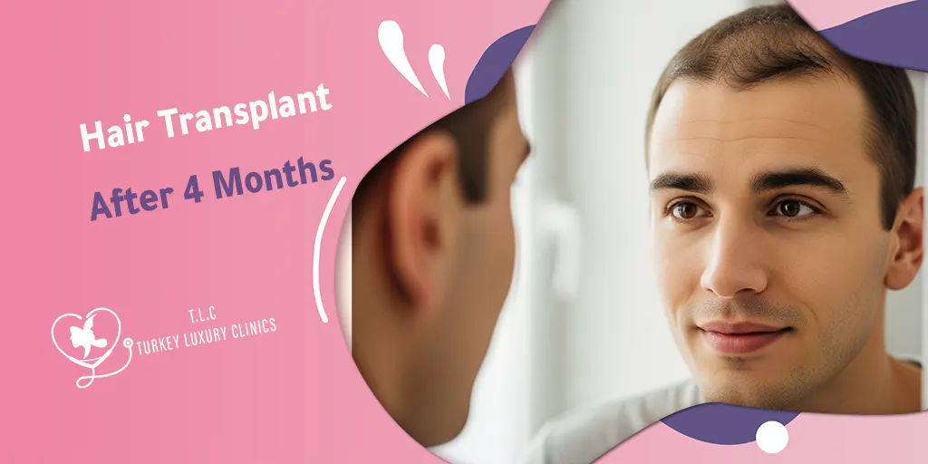 Hair Transplant After 4 Months: What to Expect With Photos