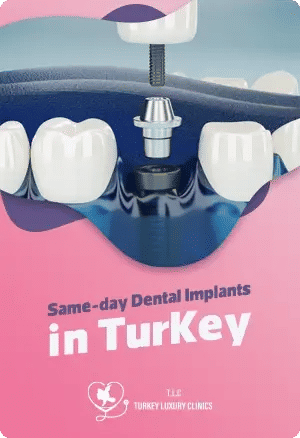 Same-day Dental Implants in Turkey – Fast & Affordable Solutions
