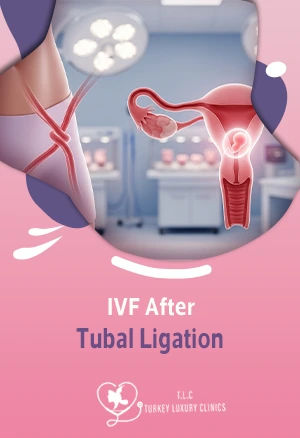 IVF After Tubal Ligation: Success Rates and Chances of Pregnancy