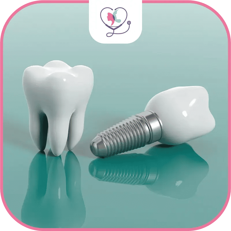 زراعة الأسنان في تركيا