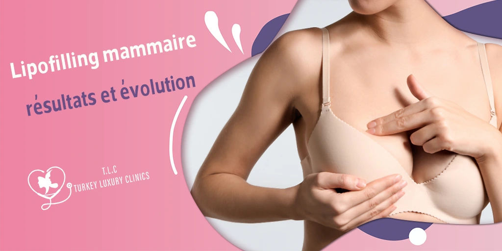 Lipofilling mammaire résultats et évolution
