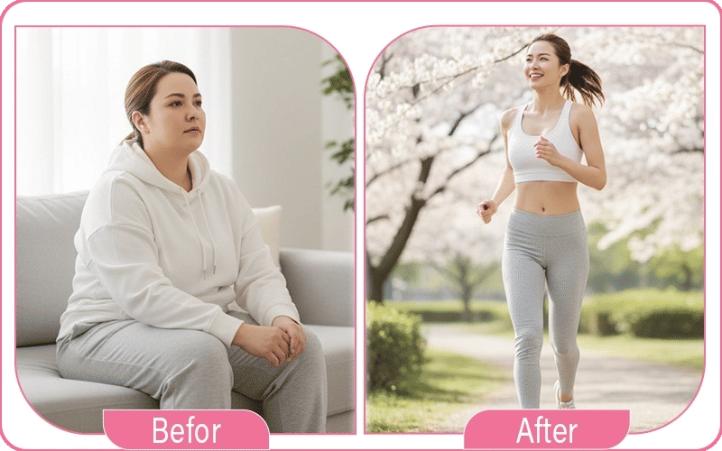 sleeve gastrectomie prix en france