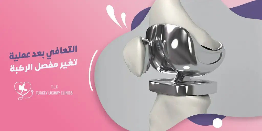خطوات التعافي بعد عملية تغيير مفصل الركبة