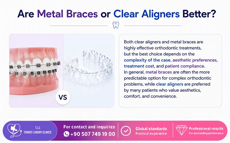 Are Metal Braces or Clear Aligners Better?