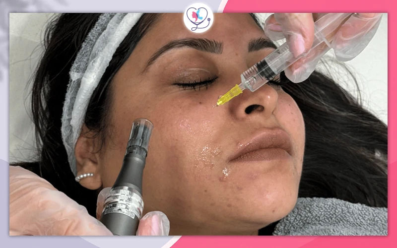 Exosome Injections for the Face and Skin