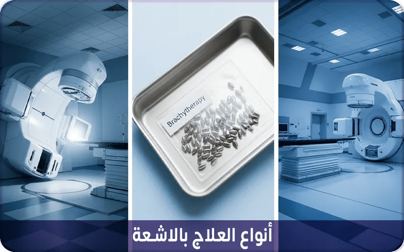 أنواع العلاج بالاشعة