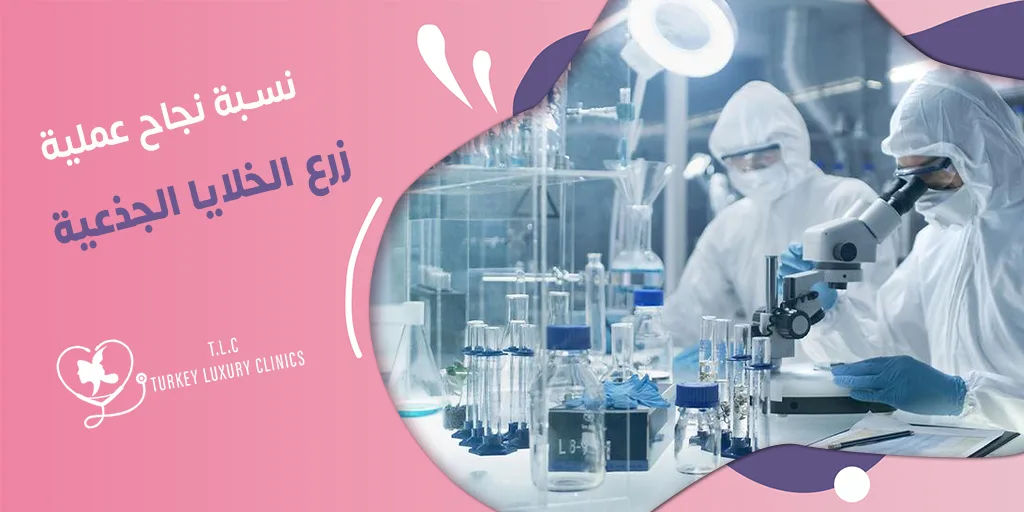 نسبة نجاح عملية زرع الخلايا الجذعية: تصل إلى 90%