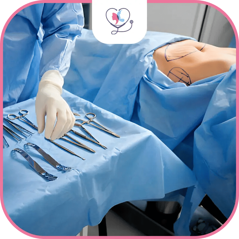 فشل عملية نحت عضلات البطن