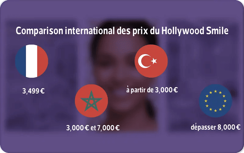 Comparison international des prix du Hollywood Smile