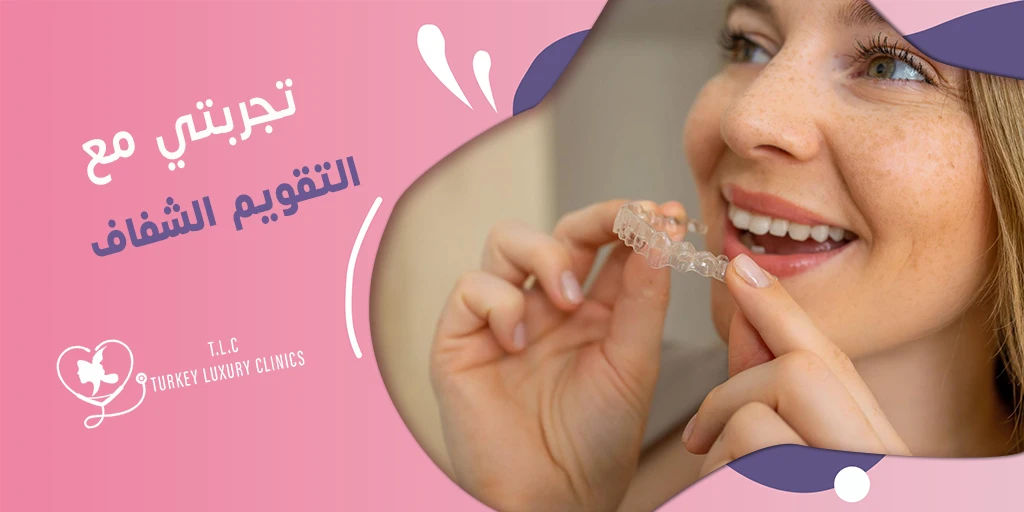 تجربتي مع التقويم الشفاف: النتائج بالصور قبل وبعد
