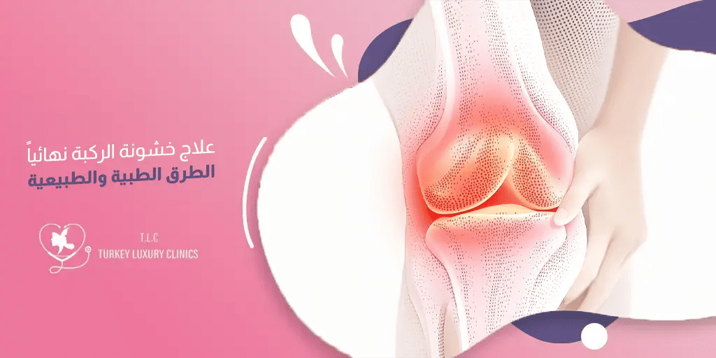 علاج خشونة الركبة نهائياً: الطرق الجراحية والطبيعية