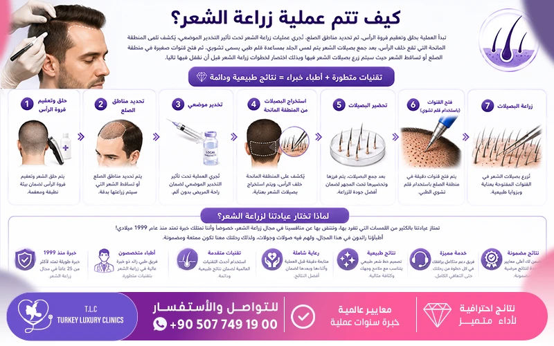 كيف تتم عملية زراعة الشعر؟