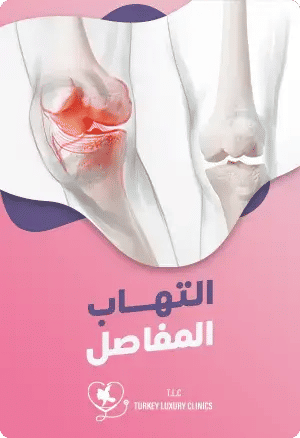 مرض التهاب المفاصل: الأسباب، والأعراض، والعلاجfeatured image