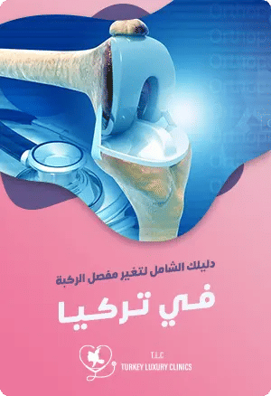 عملية تغيير مفصل الركبة في تركيا: دليلك الشاملfeatured image