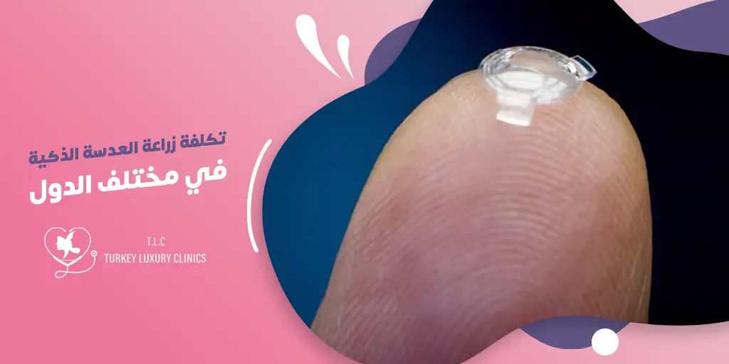 تكلفة زراعة العدسة الذكية في مختلف الدول: دراسة مقارنة