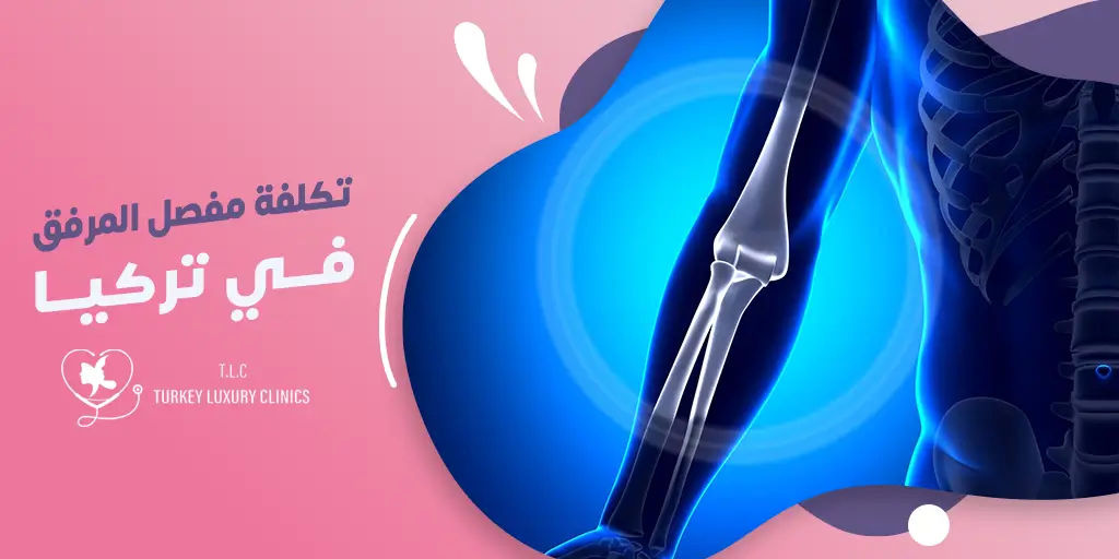 تكلفة استبدال مفصل المرفق في تركيا