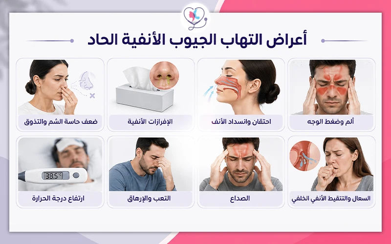 أعراض التهاب الجيوب الأنفية الحاد