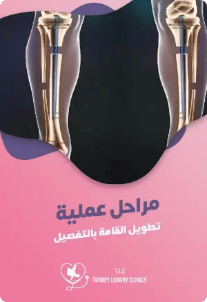 كيف تتم عملية زيادة الطول بالتفصيلfeatured image