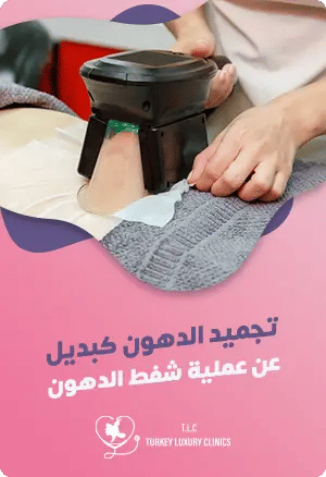 تجميد الدهون كبديل غير جراحي لشفط الدهونfeatured image
