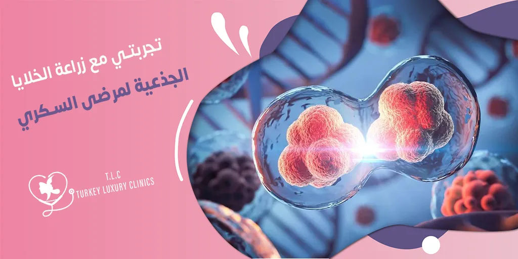 تجربتي مع زراعة الخلايا الجذعية لمرضى السكري: نسب النجاح المتوقعة