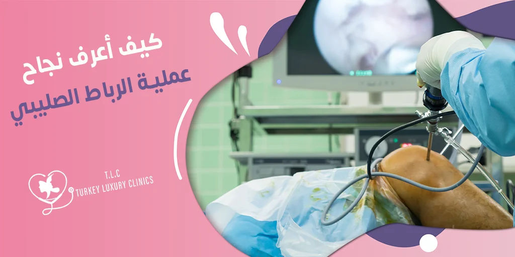 كيف أعرف نجاح عملية الرباط الصليبي؟ نسب النجاح والنتائج