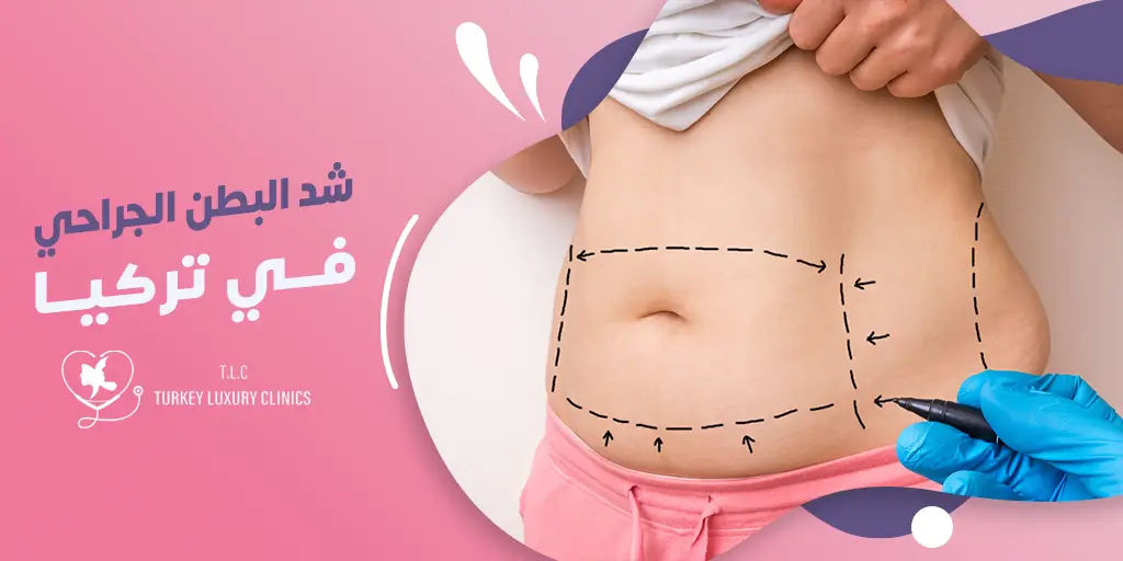عملية شد البطن الجراحي في تركيا 