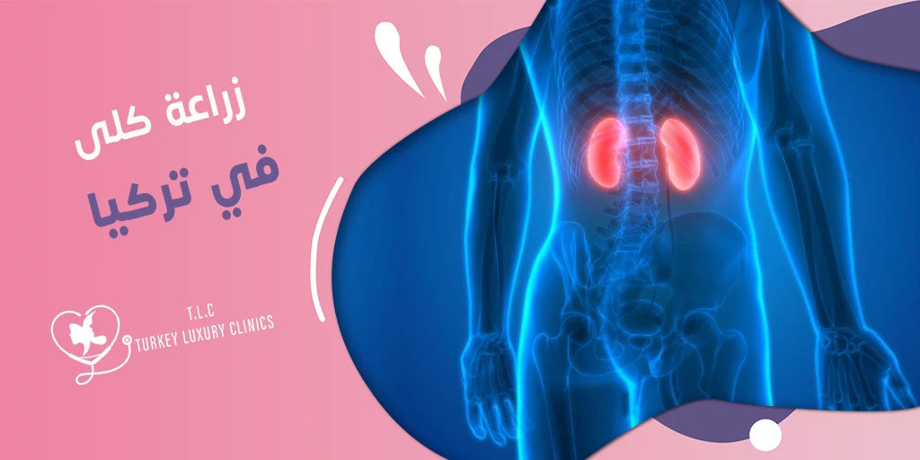 زراعة كلى في تركيا: الأسعار والخطوات في أفضل المستشفيات