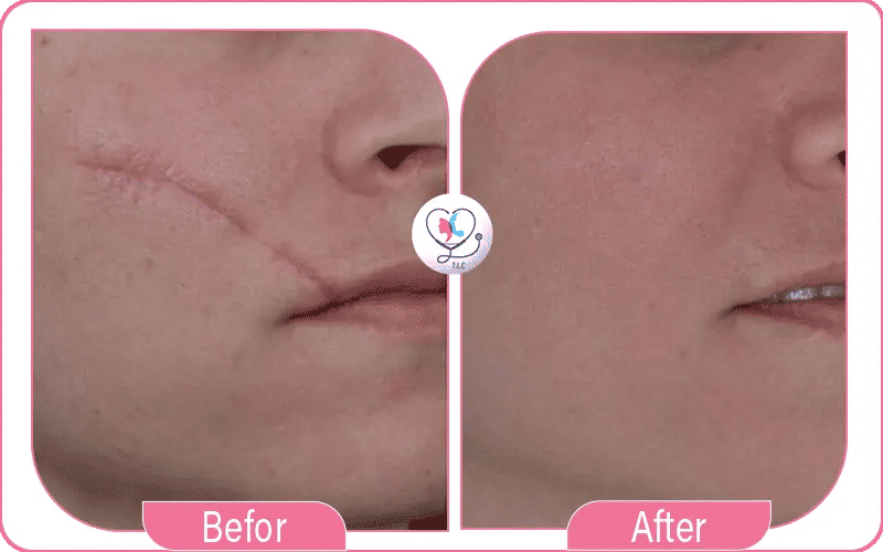 Les avantages de la chirurgie reconstructrice