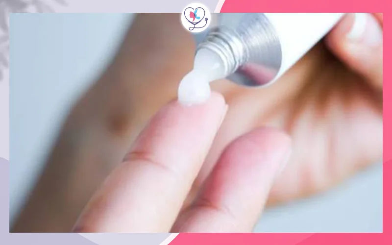 الكورتيزون الموضعي (Topical Corticosteroids)