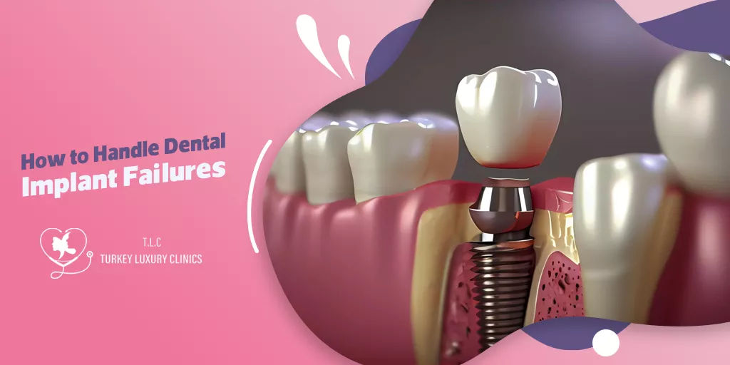 How to Handle Dental Implant Failures