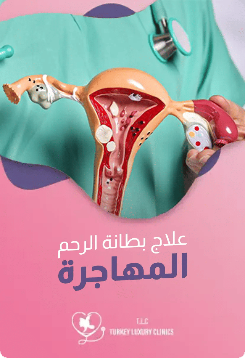 علاج بطانة الرحم المهاجرة: الجراحة والأدوية حسب كل حالة