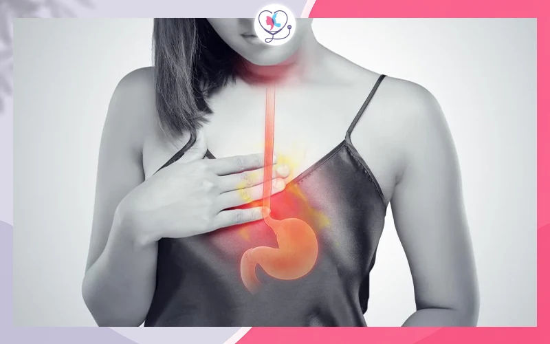 ارتجاع المريء المزمن (GERD)