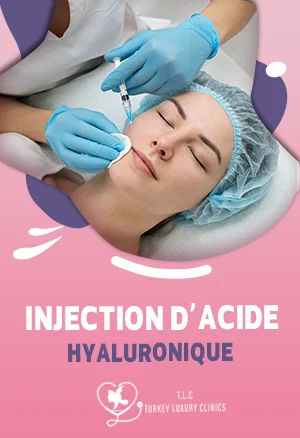 Injection d’acide hyaluronique dans les sillons nasogéniens