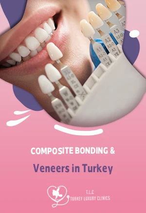 Composite Bonding & Veneers in Turkey: Prices & Packages in Istanbul, Antalya & Izmir 2026