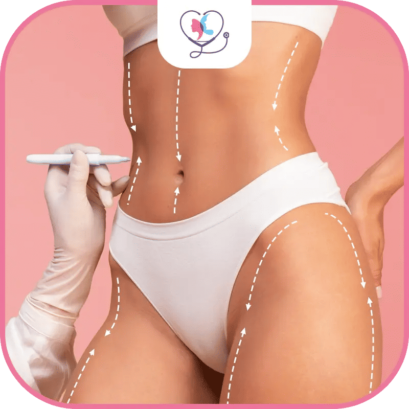 عملية نحت الجسم في تركيا