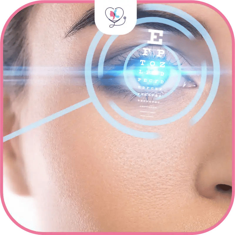 تكلفة عملية الليزك في مختلف الدول