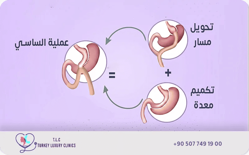 عملية تحويل مسار ساسي
