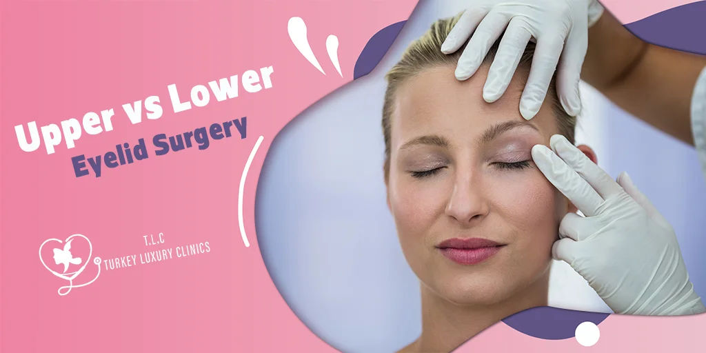 Upper vs Lower Eyelid Surgery: Full Comparison of Results, Recovery & Costs