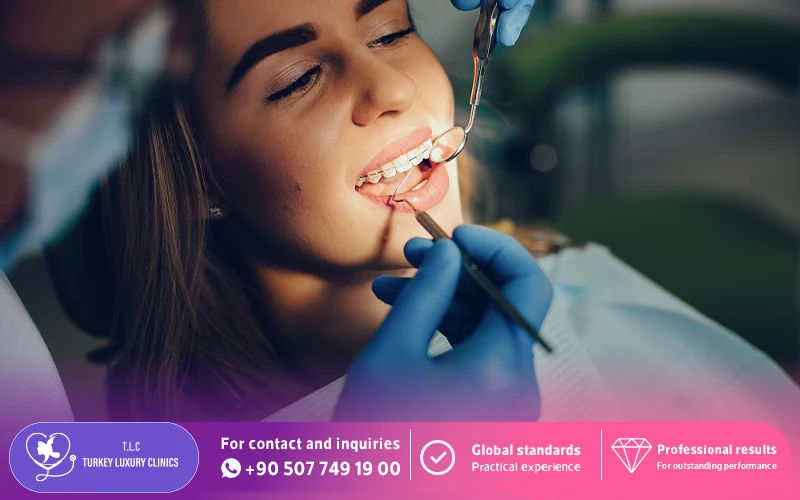 Cases Typically Require Orthodontist-Supervised Clear Aligners