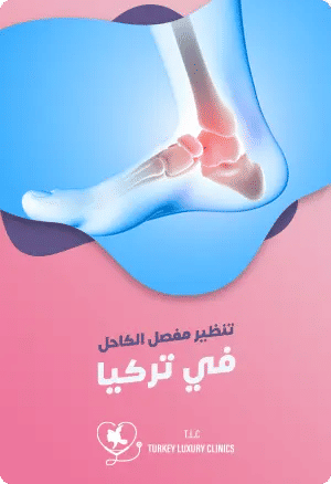 عملية تنظير مفصل الكاحل في تركياfeatured image